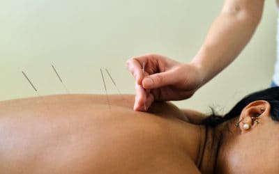 How can acupuncture help with pain relieving?