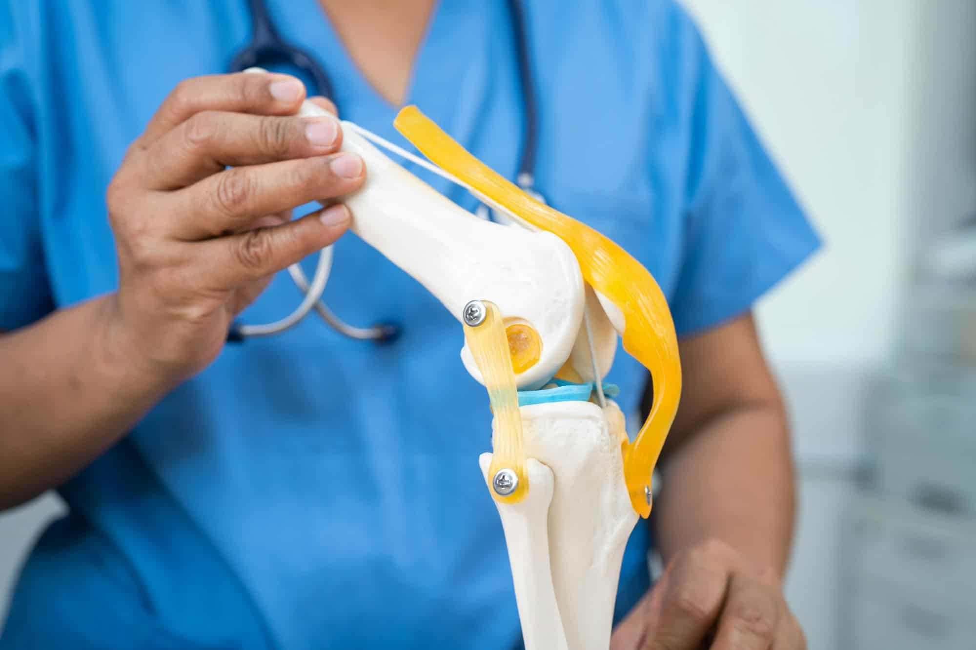 Osteoarthritis of the knee, Doctor holding human knee joint orthopedic anatomy model in hospital.